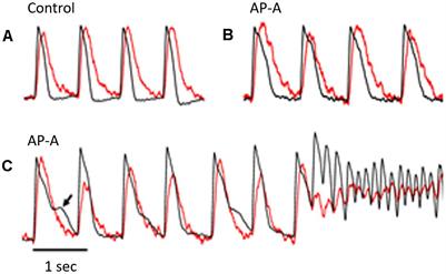 Voltage/Calcium Uncoupling Underlies Sustained Torsade de Pointes Ventricular Tachyarrhythmia in an Experimental Model of Long QT Syndrome